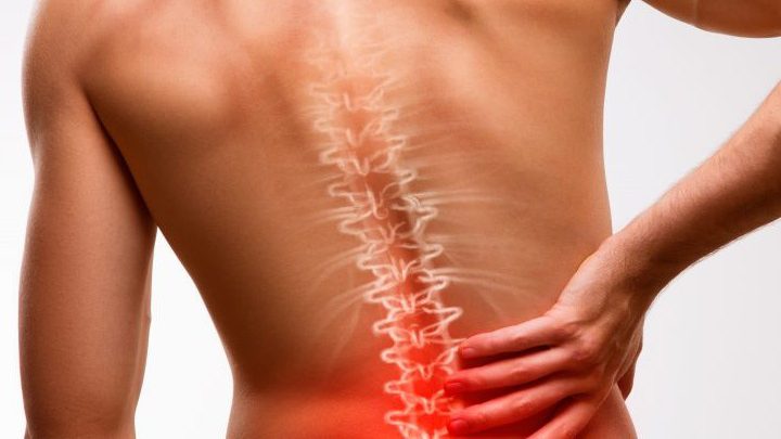 Ankylosing Spondylitis